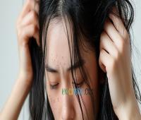 湖北女生首次漂发后头发脱落 确诊刺激性接触性皮炎