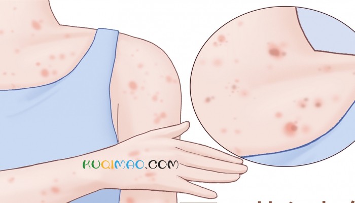 一上班就胸闷咳嗽,元凶竟是同事