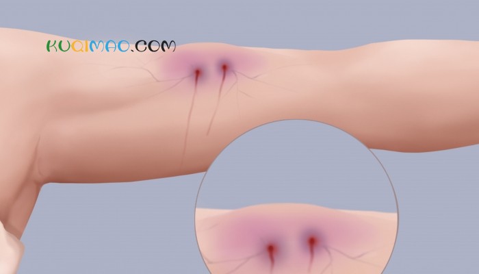 泉州一女子坠井后被蛇缠身,紧抓井壁54小时后获救