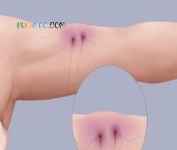 泉州一女子坠井后被蛇缠身，紧抓井壁54小时后获救