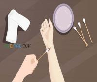 福建女子伤口结痂现白斑似发霉 网友劝说就医确认无虞